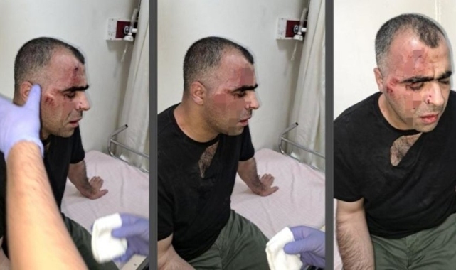 Gazeteci Sinan Aygül'e saldıran biri polis 2 koruma hakkında tahliye kararı