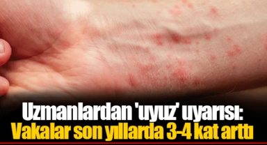 Uzmanlardan 'uyuz' uyarısı: Vakalar son yıllarda 3-4 kat arttı