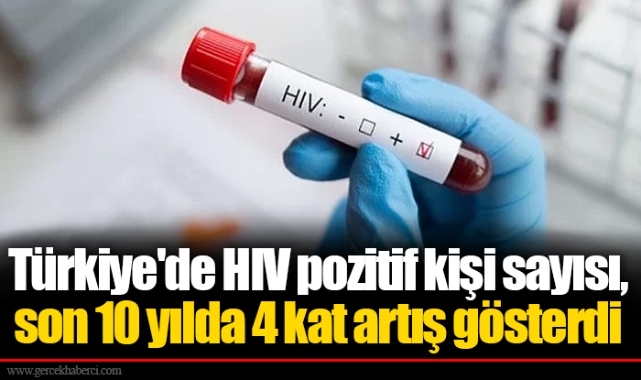 Türkiye'de HIV pozitif kişi sayısı, son 10 yılda 4 kat artış gösterdi