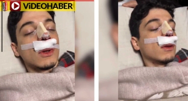Enver Paşa'nın ayakta kalmasını istemeyen anestezi etkisindeki genç viral oldu