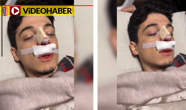 Enver Paşa'nın ayakta kalmasını istemeyen anestezi etkisindeki genç viral oldu