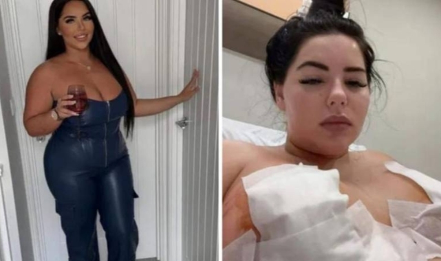 Meme ameliyatı için Türkiye&#039;ye geldi; olması gerekenden fazla deri alındığı için meme uçları öldü!