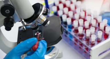 AIDS'te yeni tedavi umudu: HIV'i hücreden ayırma denemesi başarılı oldu