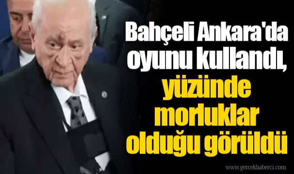 Bahçeli Ankara'da oyunu kullandı, yüzünde morluklar olduğu görüldü