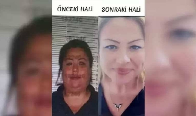 Çekleri çalıp, tekrar piyasaya süren kadın kimliğini kullandığı kardeşine benzemek için estetik yaptırmış