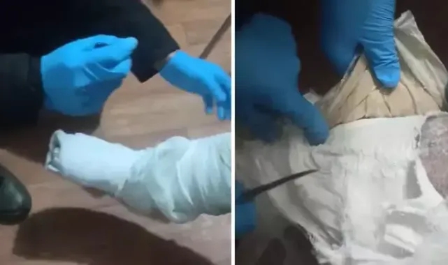 Polisin dikkatinden kaçmadı: Ayağındaki alçıdan uyuşturucu çıktı