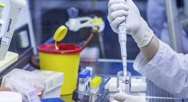 Prof. Dr. Turhan, 4 duruma vurgu yaptı: HIV belirtisi olabilir