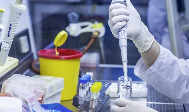 Prof. Dr. Turhan, 4 duruma vurgu yaptı: HIV belirtisi olabilir