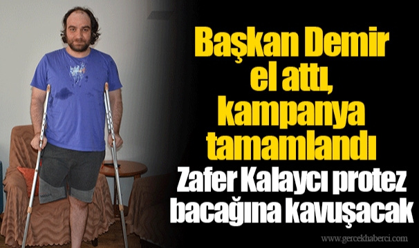Zafer Kalaycı protez bacağına kavuşacak
