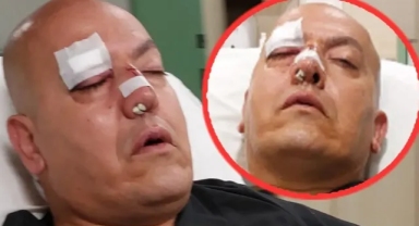 Saldırıya uğradı, burnu kırıldı: O doktor Ahmet Kurt hastası için böyle seferber oldu