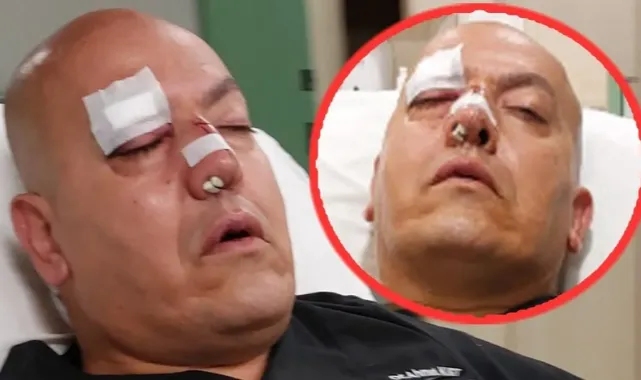 Saldırıya uğradı, burnu kırıldı: O doktor Ahmet Kurt hastası için böyle seferber oldu