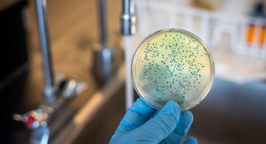 Pseudomonas aeruginosa'nın Genetik Soy Ağacı: 596 Virüs Türüyle İlişki Tespit Edildi