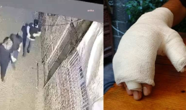 Diyarbakır’da Türkan Elçi'nin ailesine ait kafeye "açık kıyafetli kadınlar geliyor" gerekçesiyle ikinci saldırı: 2 yaralı