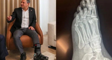 Özgür Özel, ayağının röntgen filmini paylaştı