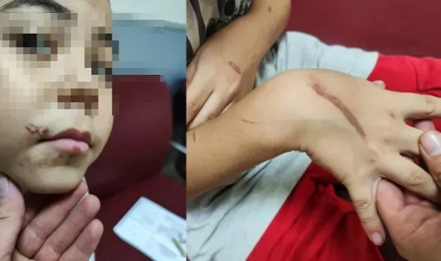Komşuların ihbarı gerçeği ortaya çıkardı...  Küçük çocuğa kızgın tornavidalı işkence