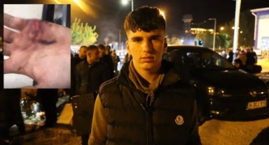 Kayyum eylemlerinde gözaltına alınan çocuğa polis şiddeti: Eline altı dikiş atıldı