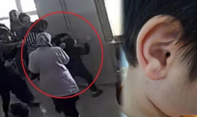 Özel Eğitim Okulunda Skandal! Öğretmenler Otizmli Öğrenciyi Darbetti