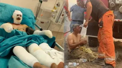 Orman yangınında yaralanan orman işçisinin son hali ortaya çıktı