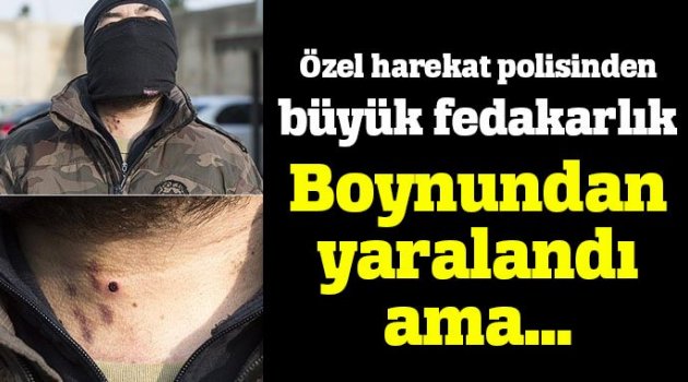 Yaralanan özel harekatçı...
