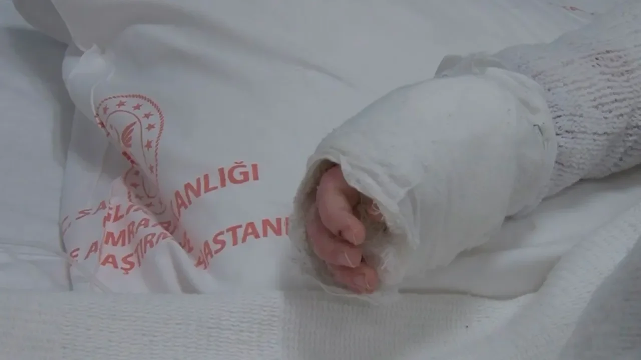 20 aylık bebeğin üzerine kaynar su döküldü! Vücudunun yüzde 27’si yandı