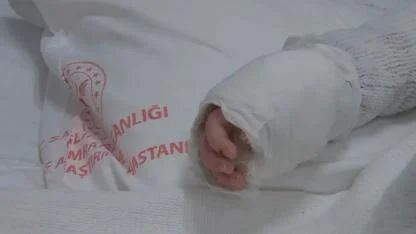 20 aylık bebeğin üzerine kaynar su döküldü! Vücudunun yüzde 27’si yandı